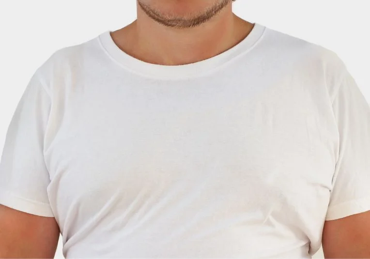 Gynecomastie - Reduction de la glande chez l'homme - Dr Chen Lee