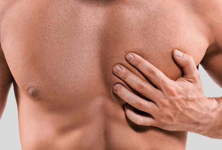 Élément de menu Réduction mammaire masculine et gynécomastie