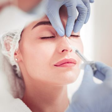 Injection de produit de comblement nasal pour rhinoplastie non chirurgicale