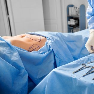 consultation d'abdominoplastie avec le Dr Chen Lee